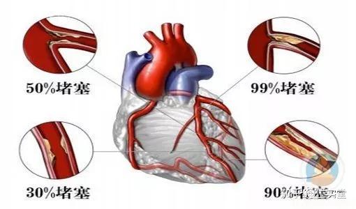 v2-aa848f77cf796fee5ca8aefde234b75a_r.jpg