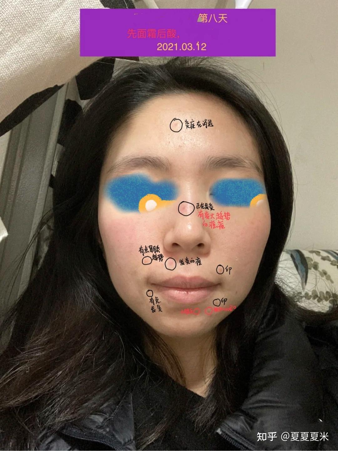 v2-aa8c715dd80c450d3f06e5586de5edde_r.jpg