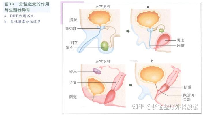 存在不均一性,即虽然两性都可受累,但只有男性患者出现临床表现异常