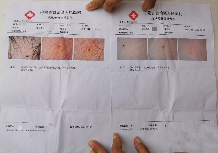 v2-aa9b6fcd5ff106f98d8b6cb4fa0c361b_1440w.jpg?source=172ae18b