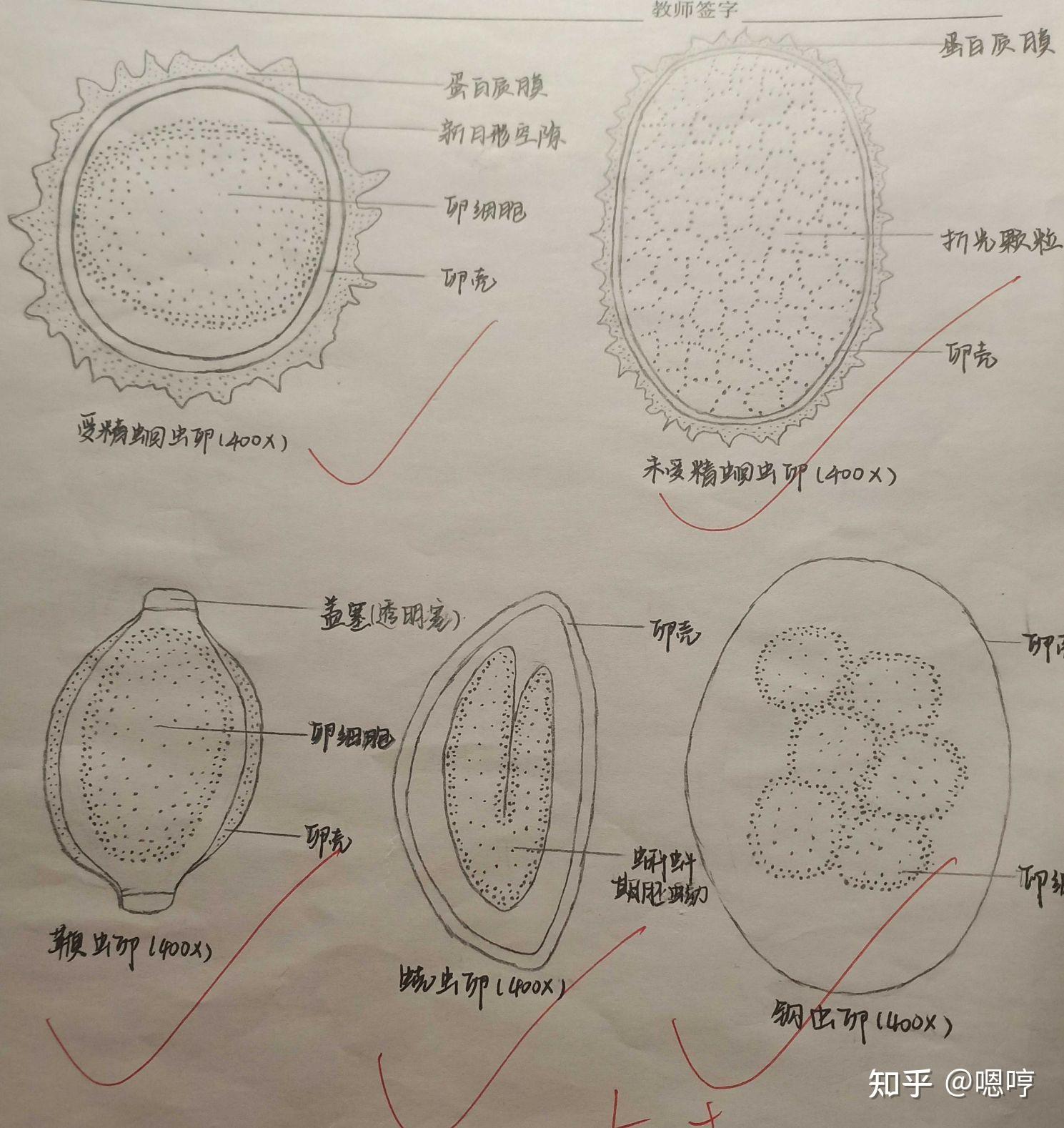 钩虫卵手绘图片图片