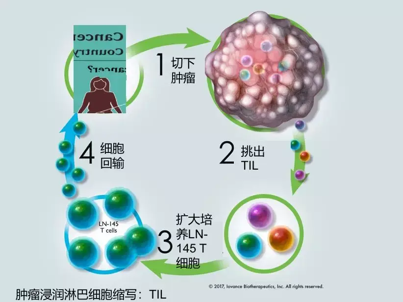 控制率高達85宮頸癌新型細胞療法有望明年上市