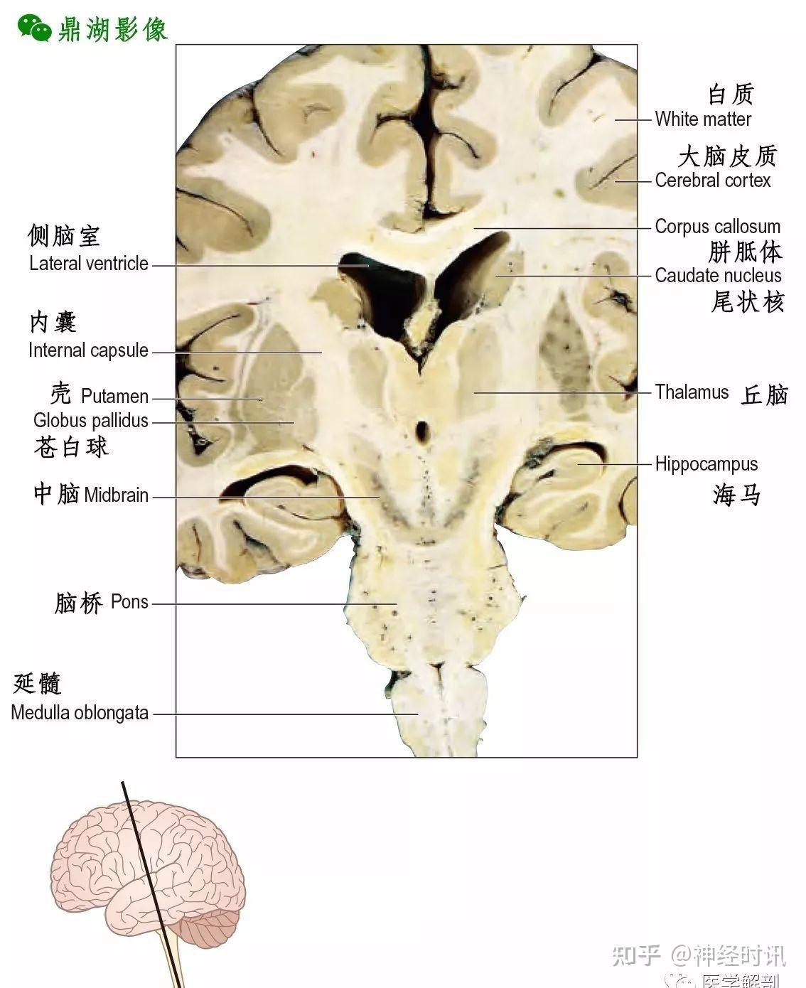 人類的大腦半球是腦的重要組成部分,它充滿整個顱前窩和顱中窩,並與