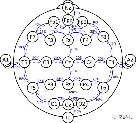 脑电图定位三点五步法图片
