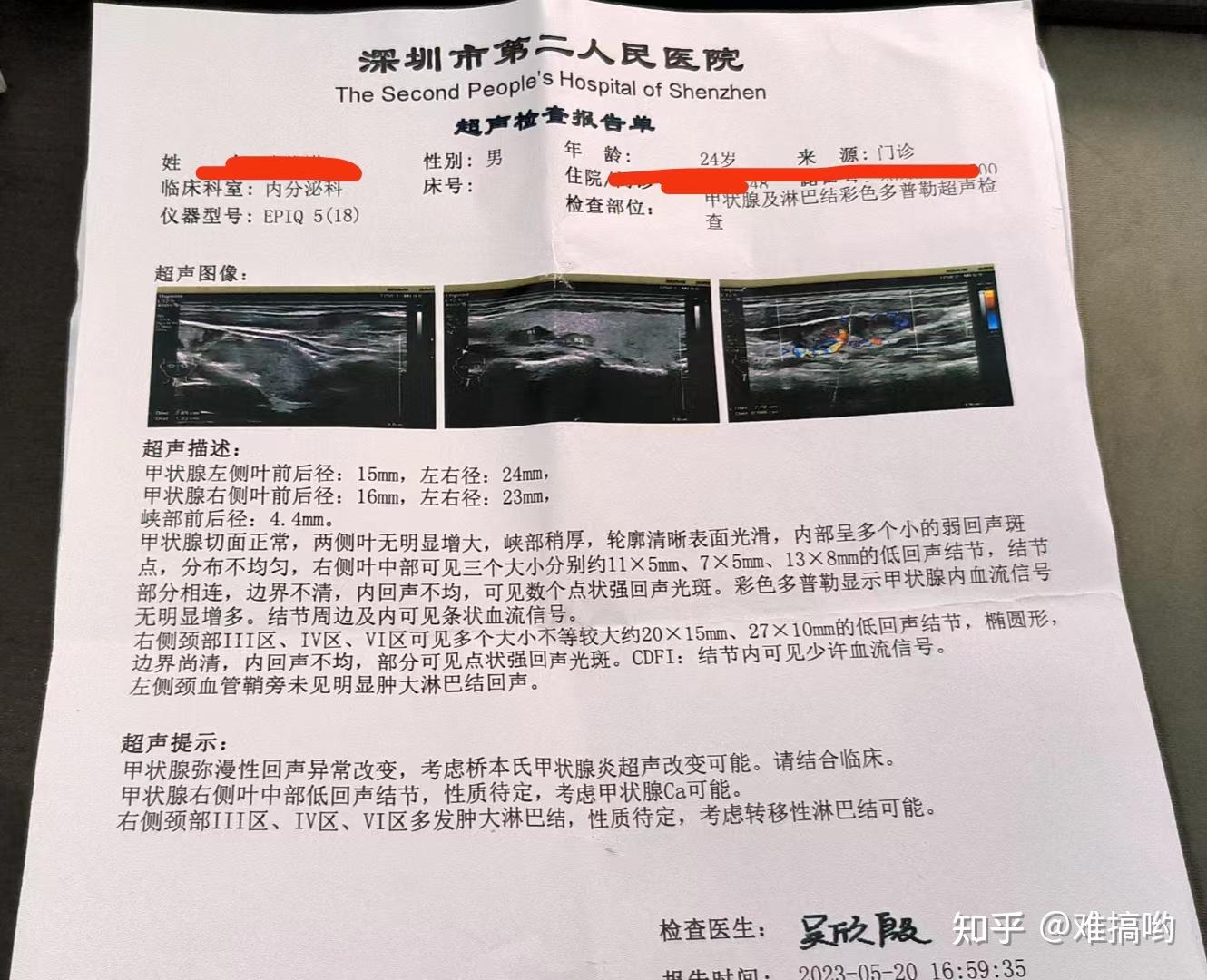 关于我,一个月切了两刀甲状腺的经历