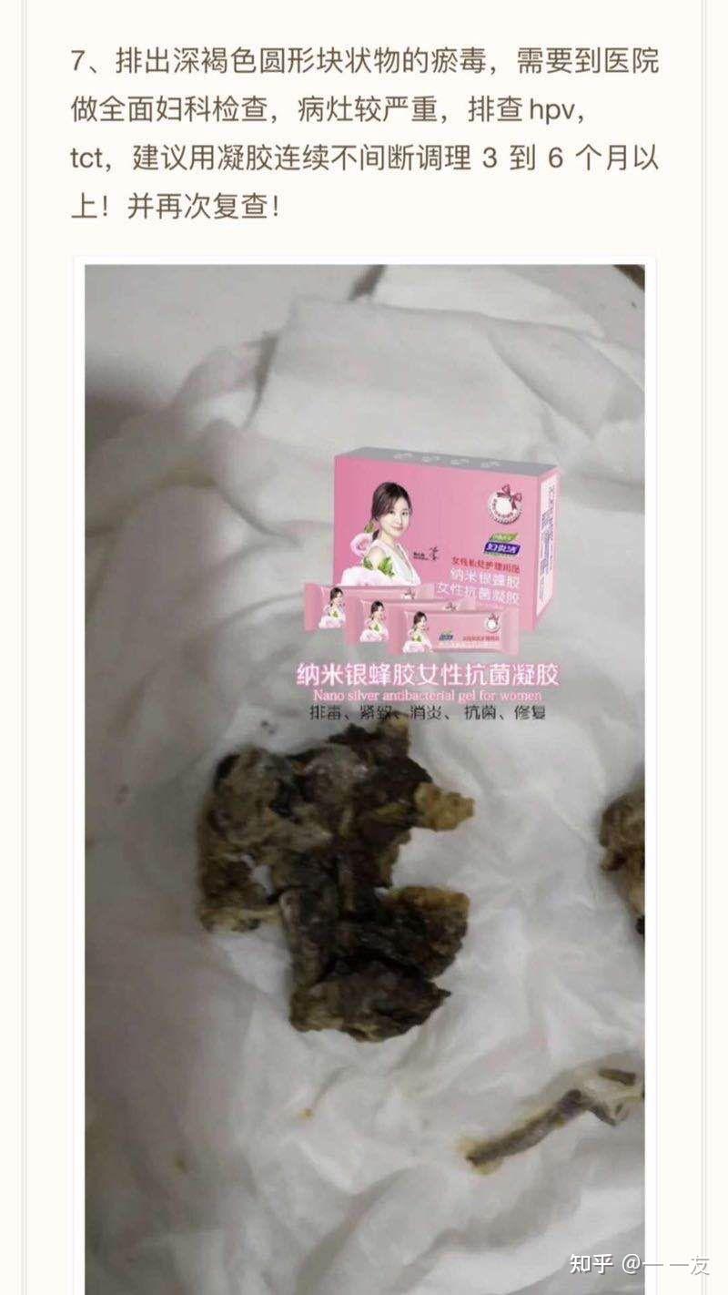 女用避孕凝胶排泄物图片