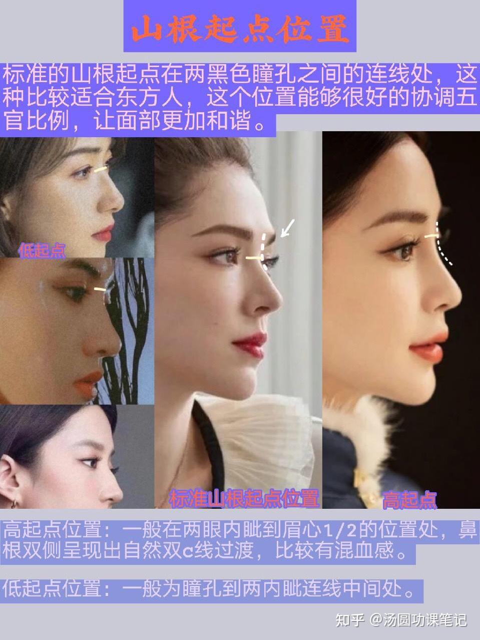 隆必看60山根到底怎么做才好看