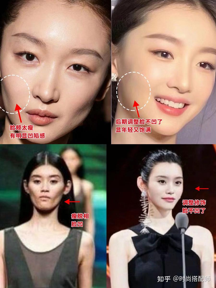 中年发腮最毁颜值?脸部凹陷比发腮可怕多了,显老又显凶 - 知乎