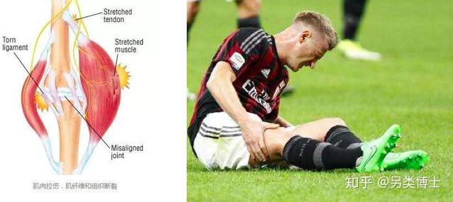 肌肉酸痛肌肉拉伤如何界定运动过量如何快速恢复