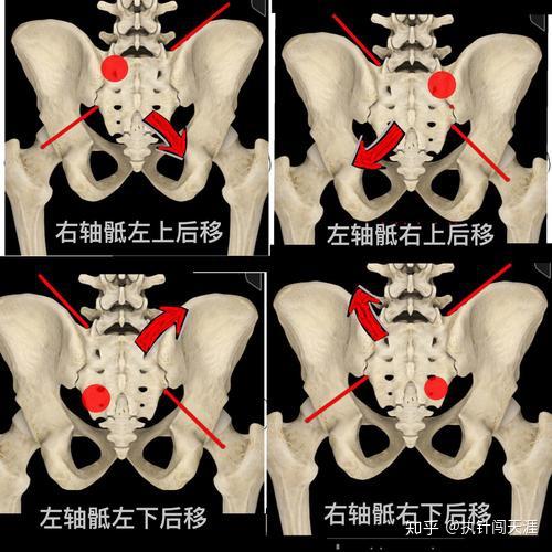 骶骨靜悄悄,肯定在作妖.