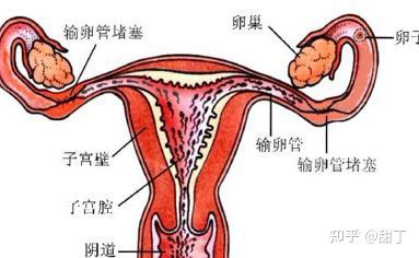 宫外孕术后如何快速恢复 这样调理怀孕不再愁 知乎