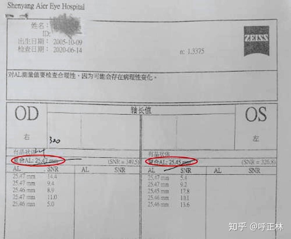 眼轴28平时应该怎么弄