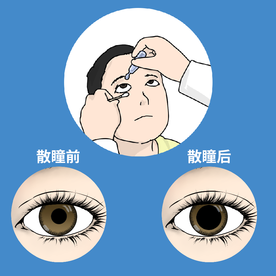 家长最关心的“散瞳验光”那些事，一次给您讲清楚！ - 知乎