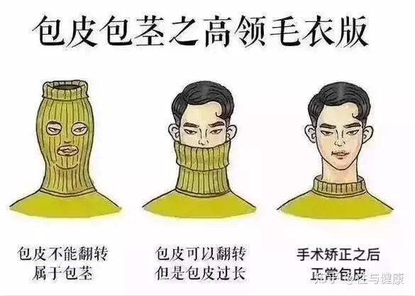包皮垢对健康的危害绝对不可忽视! - 知乎