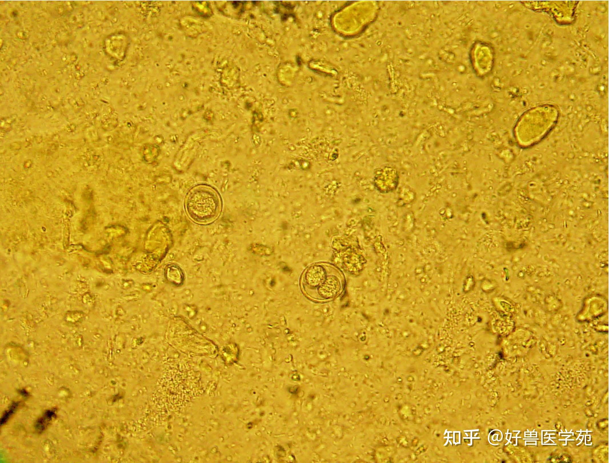 球虫病粪便图片显微镜图片