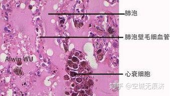 病理学实验1 - 知乎