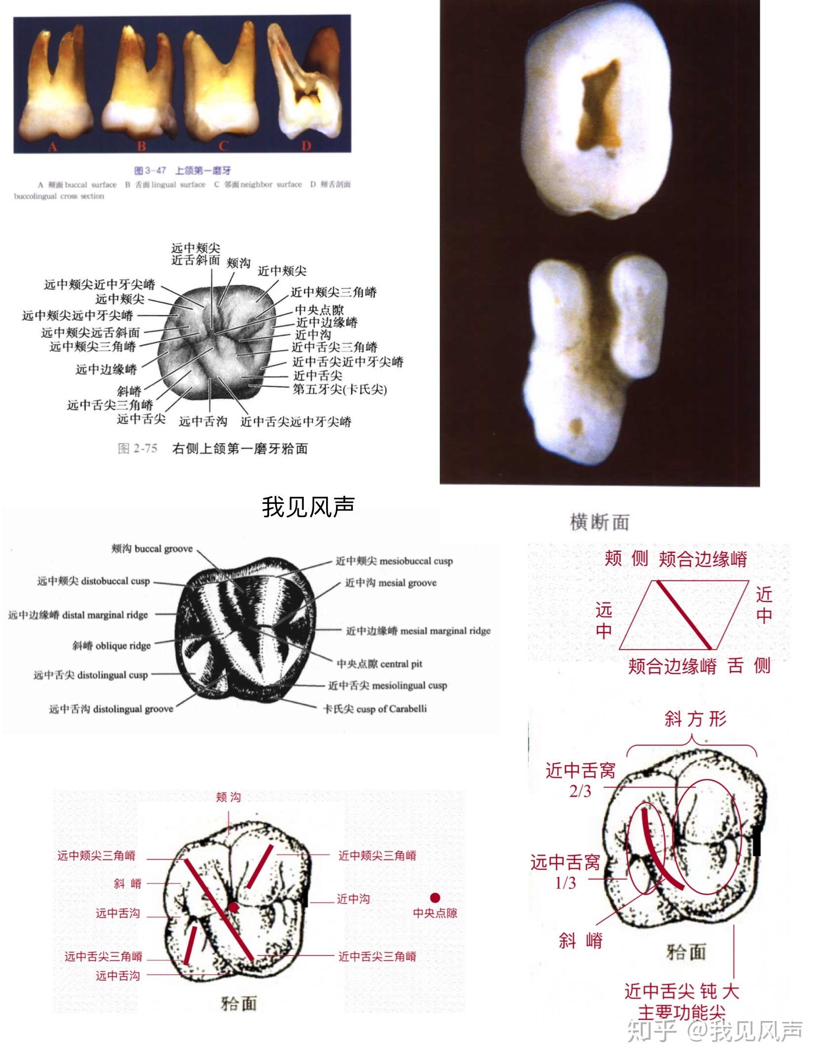 下颌七根管分布图图片