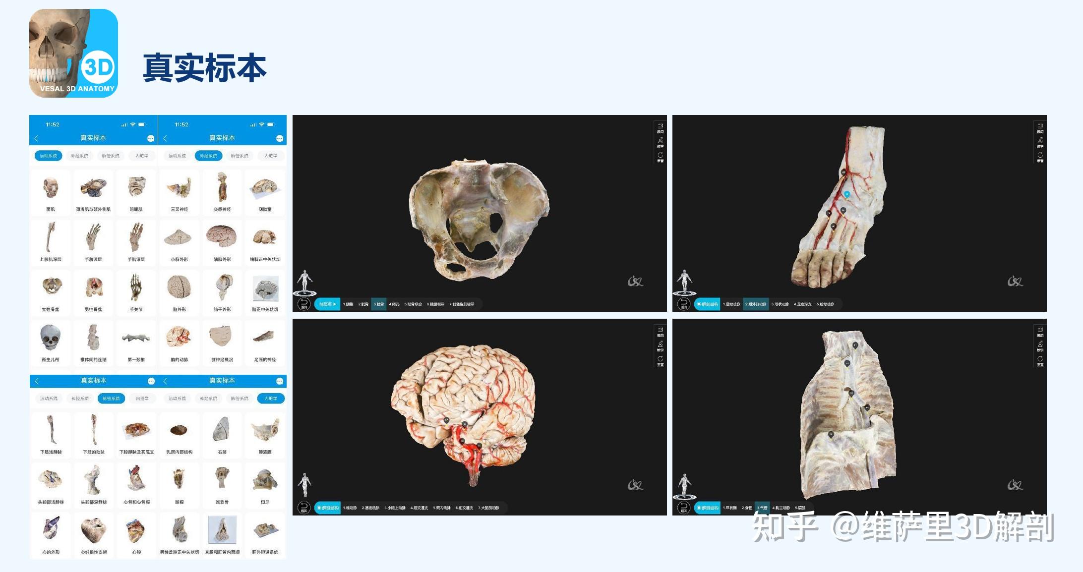医学生3D解剖软件首选指南：维萨里3D解剖APP助力小白成为系统解剖大神 - 知乎