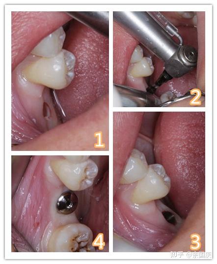 v2-aebb60176ceca02ca4d36cec96a82b2e_r.jpg