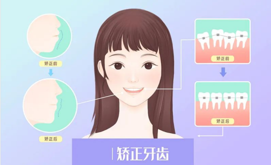 牙根短能矫正牙吗?牙齿矫正后脱落是正畸失败吗? - 知乎