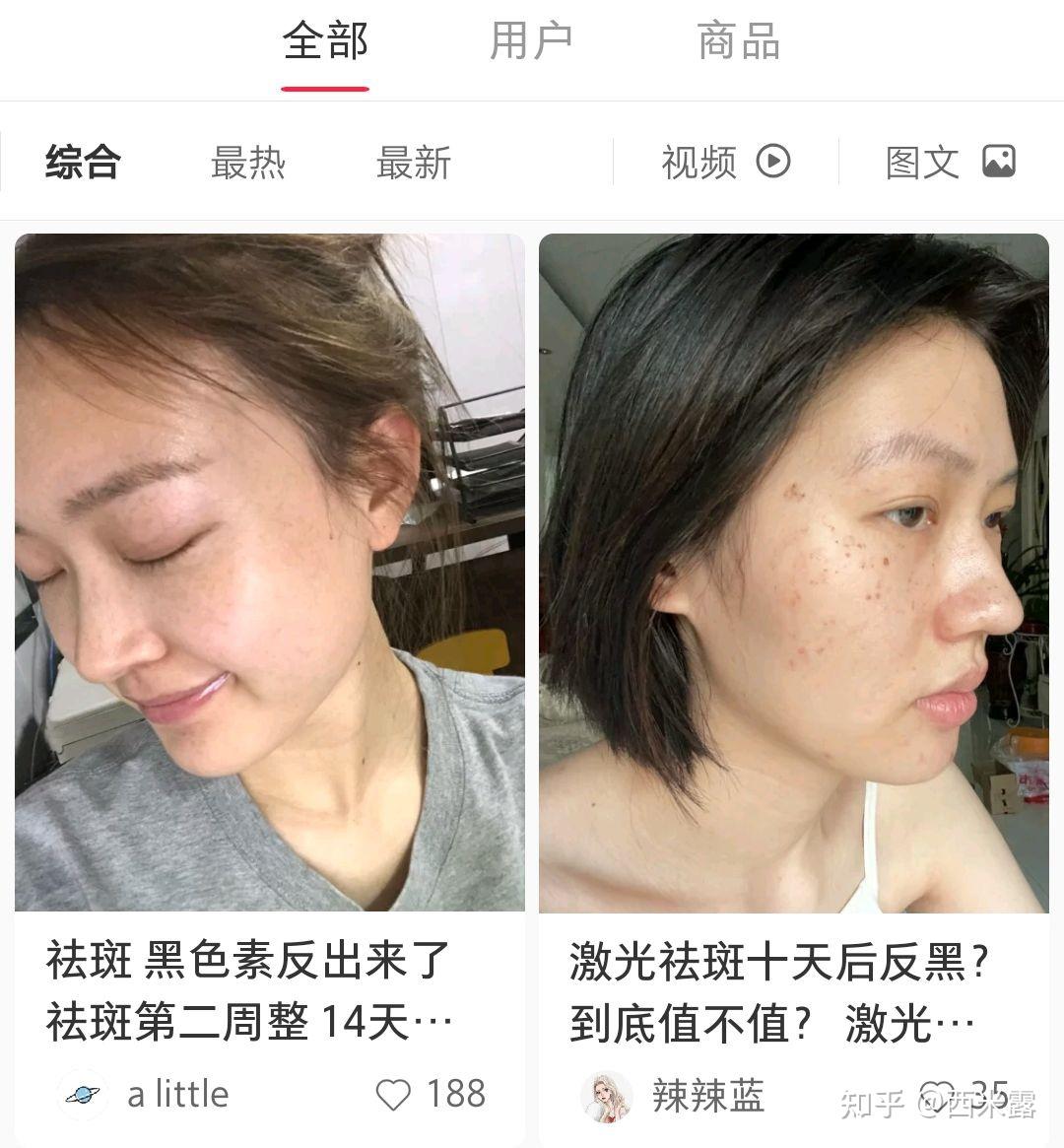 再凑凑自己考祛斑霜变干净的脸:就格外注重皮肤减少黑色素了!①防晒