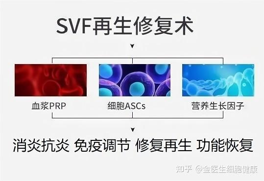 SVF自体脂肪干细胞再生修复技术，膝关节炎患者的新希望! - 知乎