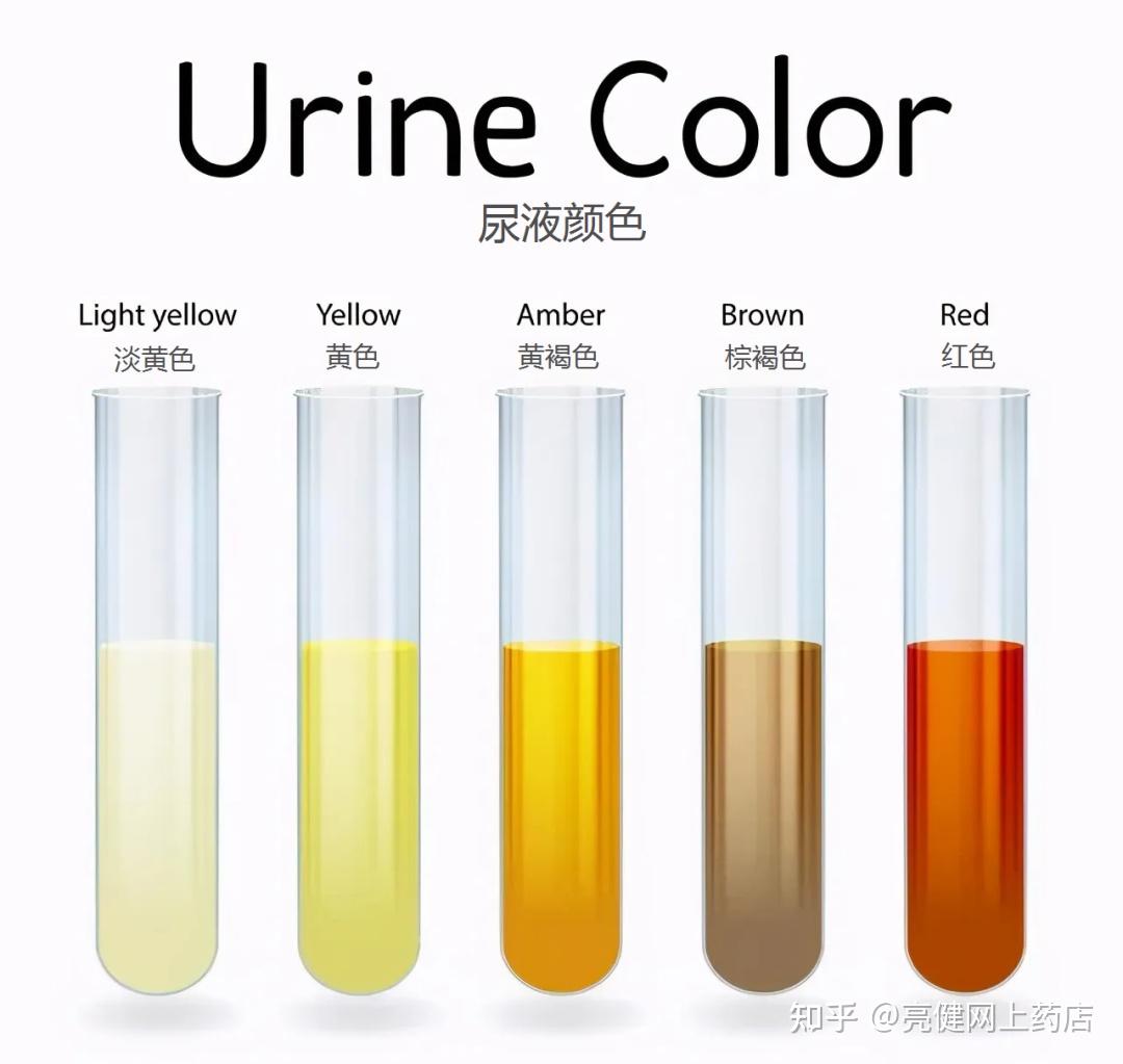 尿液的颜色, 身体的状况 • Know Body Condition Based On The Color Of Urine – Good ...