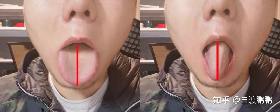舌部操口齿清晰舌头中纵线力量舌部操动作详解都不要错过