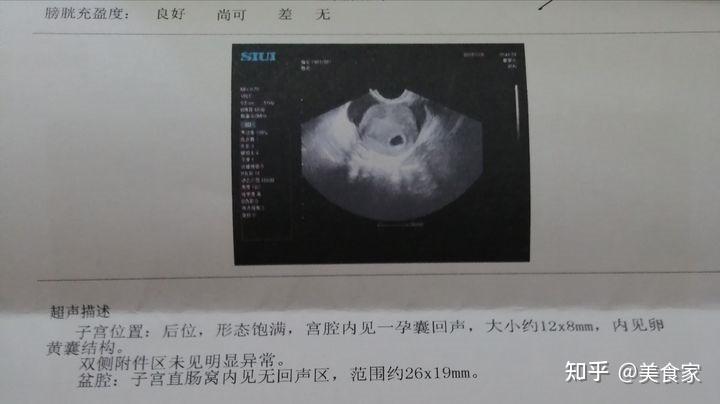成都无痛~人工流产手术~意外怀孕~医院