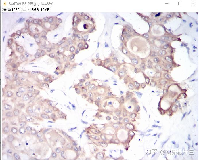 技能爆发！快速用Image J定量分析免疫组化图！ - 知乎