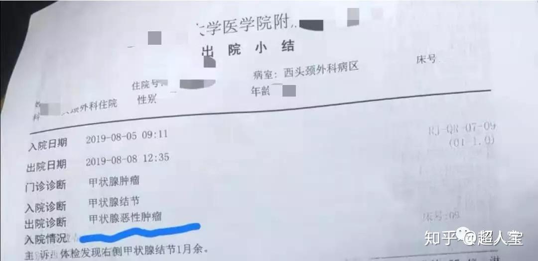 防止醫生把口述的病史留在病歷本上,影響後期的理賠在出院之前,超哥