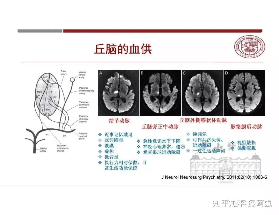 间脑-背侧丘脑 - 知乎