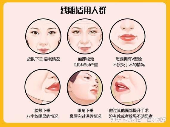 面部线雕做一次能维持多久呢