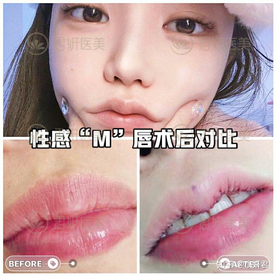 什么是M唇?M唇的判定标准是什么呢?💡 - 知乎