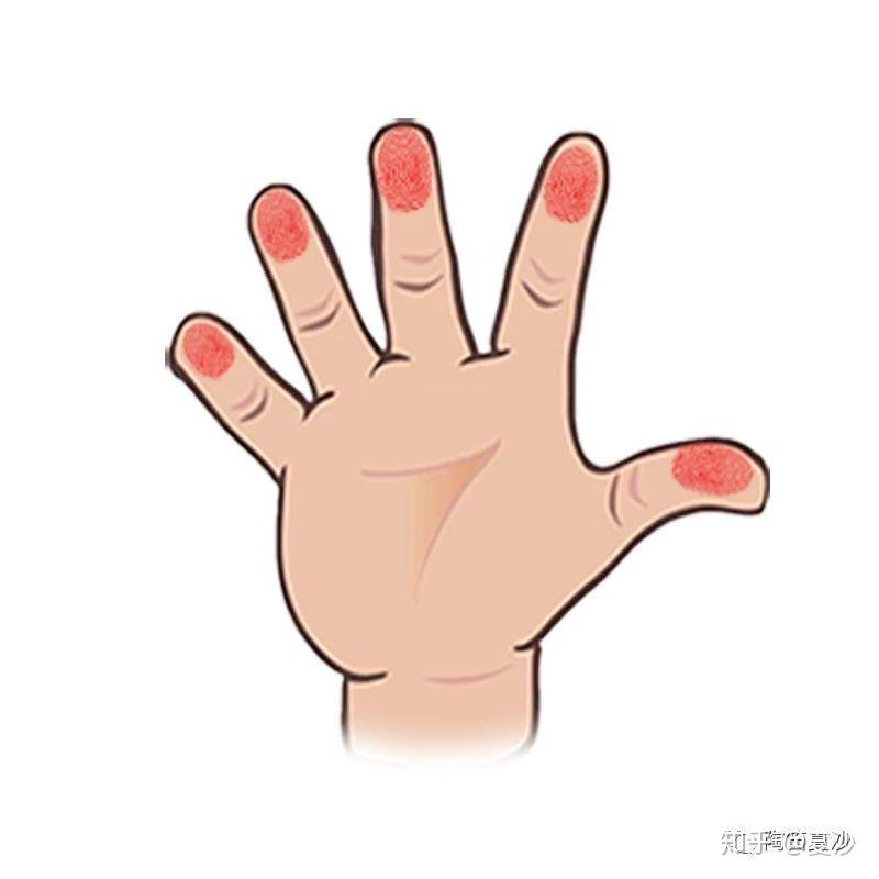 嘬手指声音 v2-b08f4f943ba5caabf87d8054dfeb0752_r.jpg