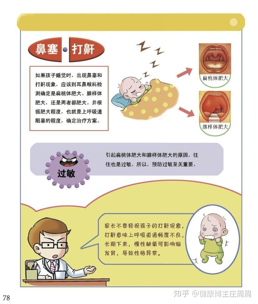 首大石萍:腺样体肥大的治疗和康复办法