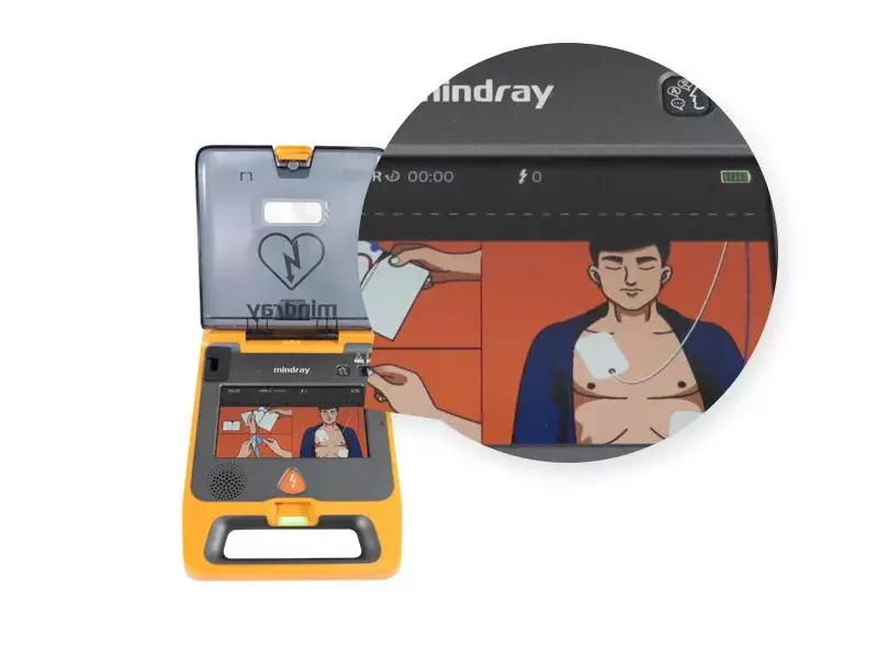 自动体外除颤器又称自动体外电击器,心脏除颤器及傻瓜电击器等,是一种