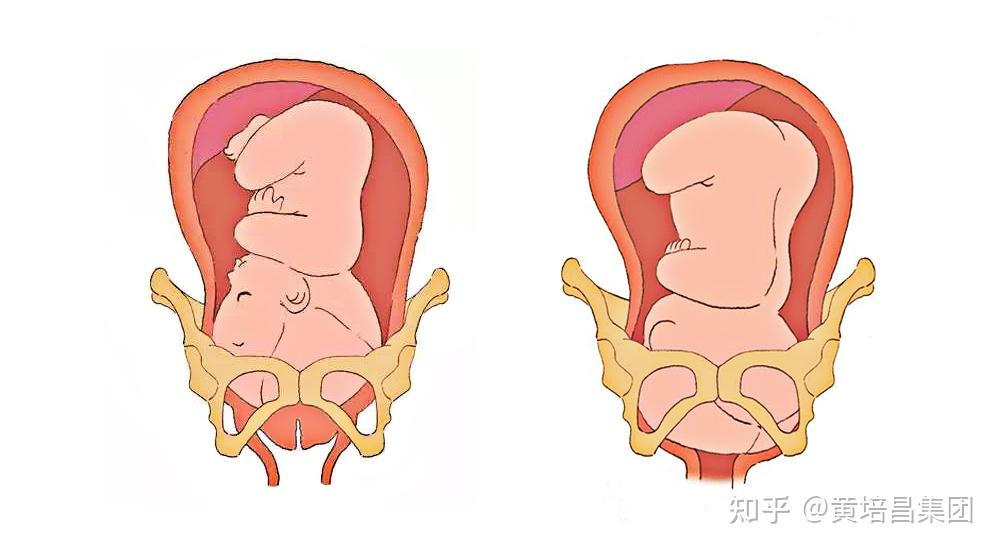 除了由子宫,子宫颈,阴道和外阴构成的软产道外,骨盆是产道的最重要的