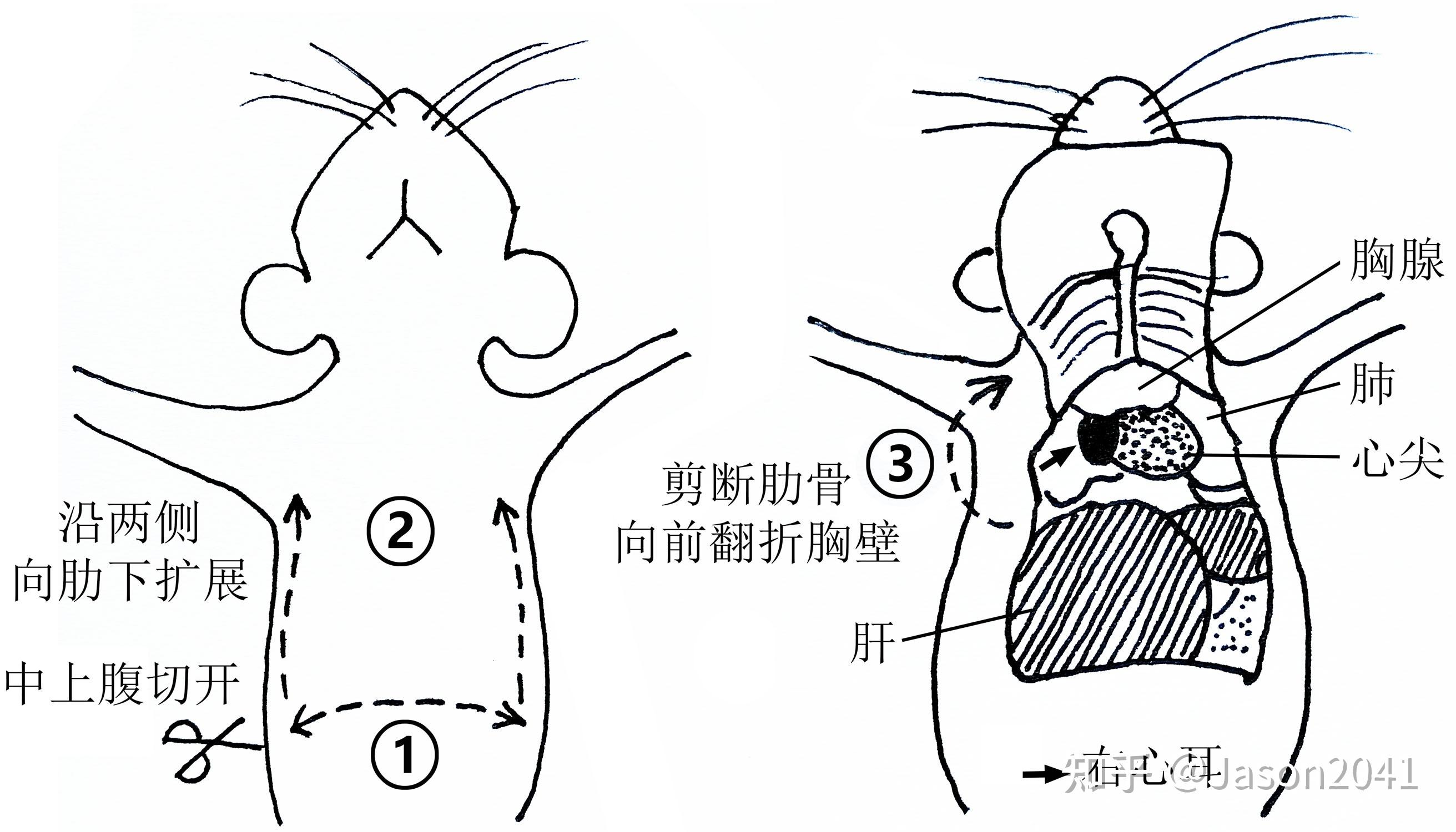 小鼠经心脏灌注固定和组织标本取材操作