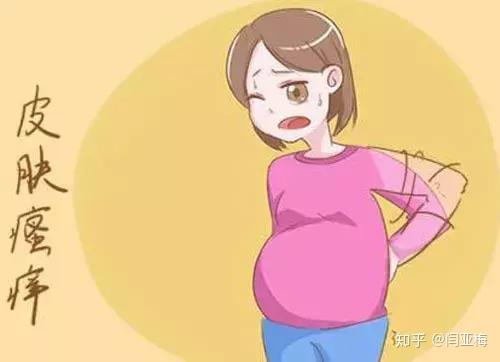 孕晚期皮肤瘙痒 有可能是妊娠期肝内胆汁淤积症 知乎 孕晚期皮肤瘙痒 有可能是妊娠期肝内胆汁淤积症 知乎