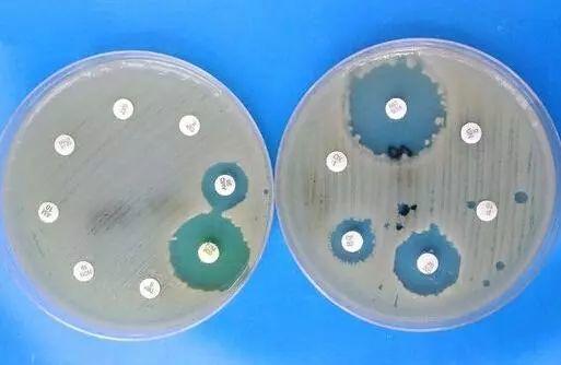双向琼脂扩散图片