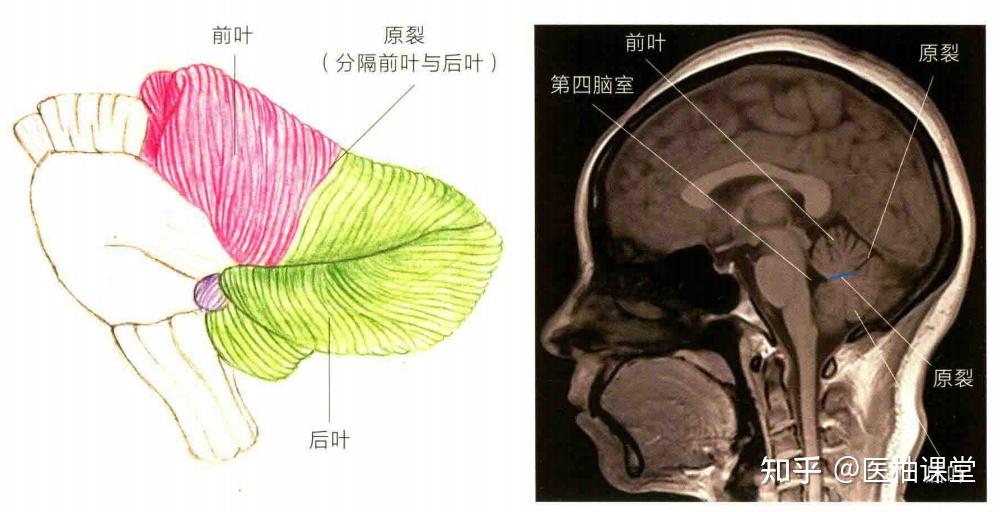 小脑表面的沟裂