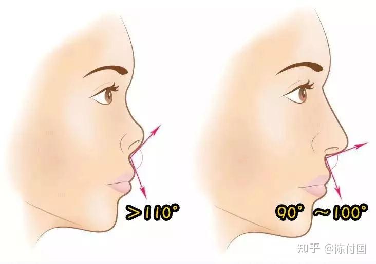 朝天鼻怎么改善? - 知乎