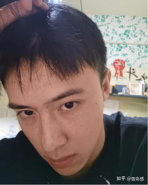 慌啥!其实男生去黑眼圈超简单的.
