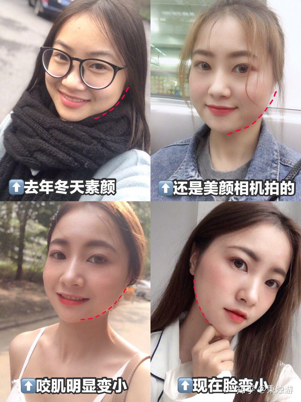 想要巴掌脸想要变美