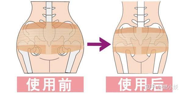 女人的屁股會看起來又扁又大,那是因為胯骨變大,生完孩子之後,會慢慢