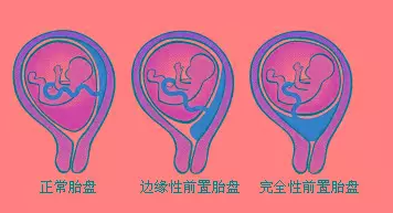 v2-b1d73ed8f5194a1acf93000310c670ab_1440w.jpg?source=172ae18b