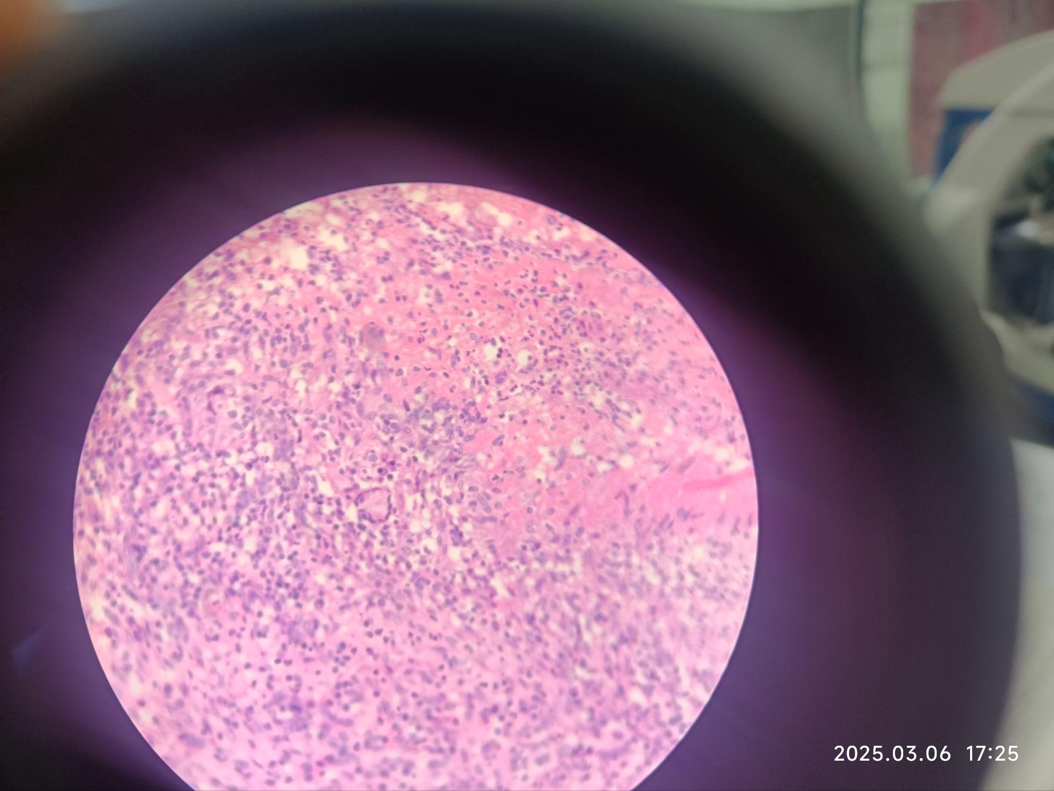 病理学实验切片