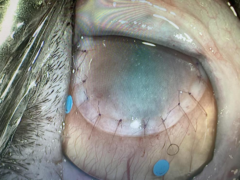 猫咪眼球表面突然变黑警惕坏死性角膜炎手术治疗可恢复