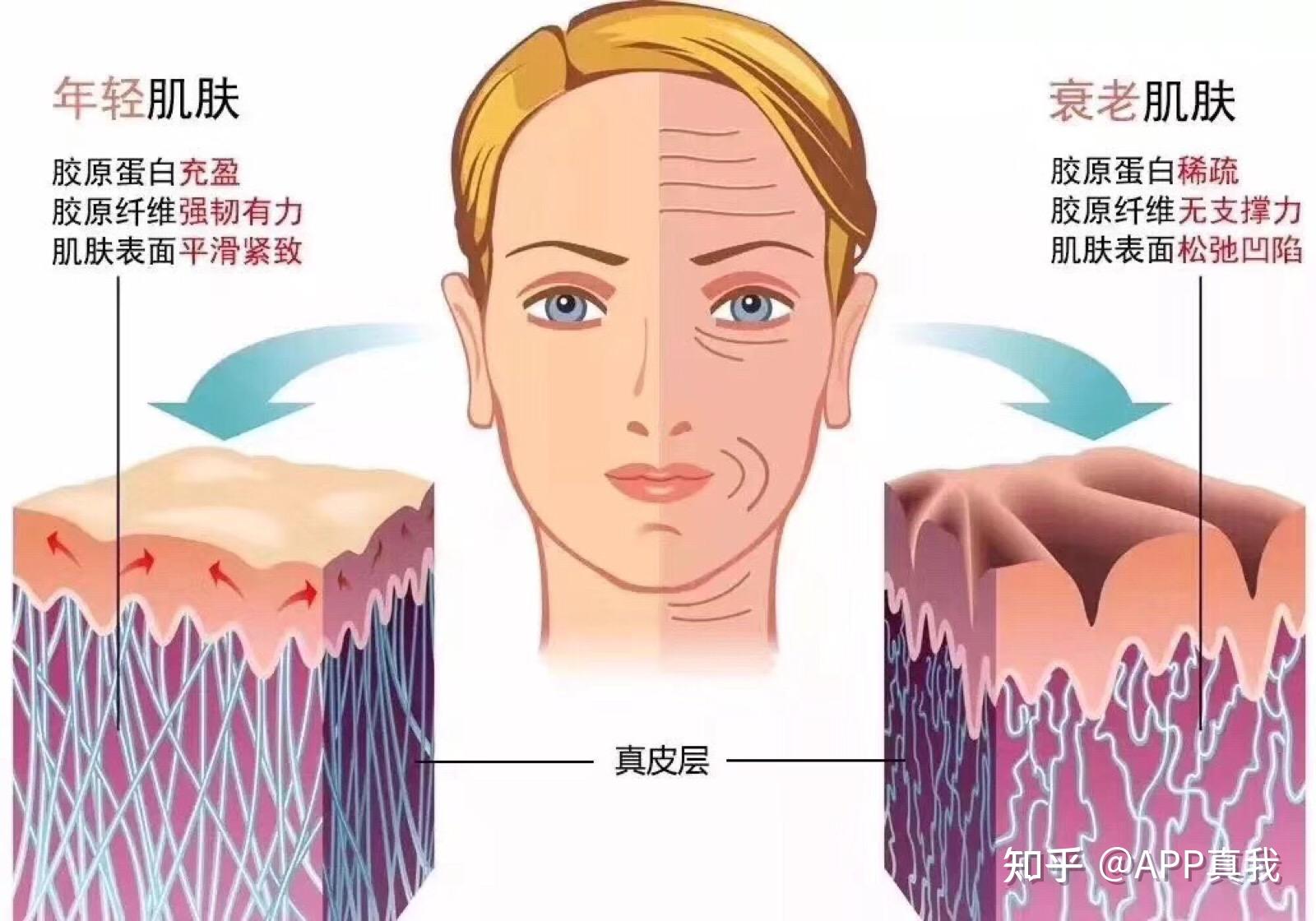 皮肤衰老的根本原因是什么呢